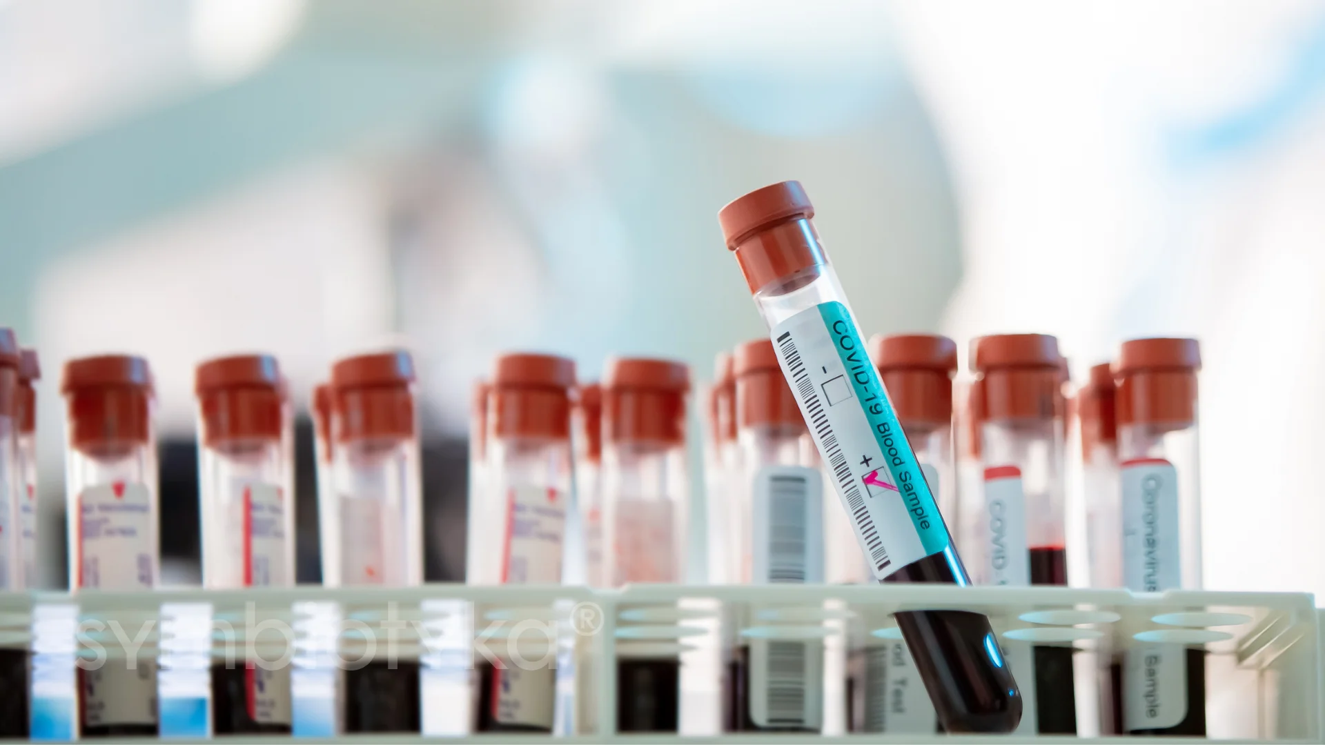 A row of medical tubes filled with blood.