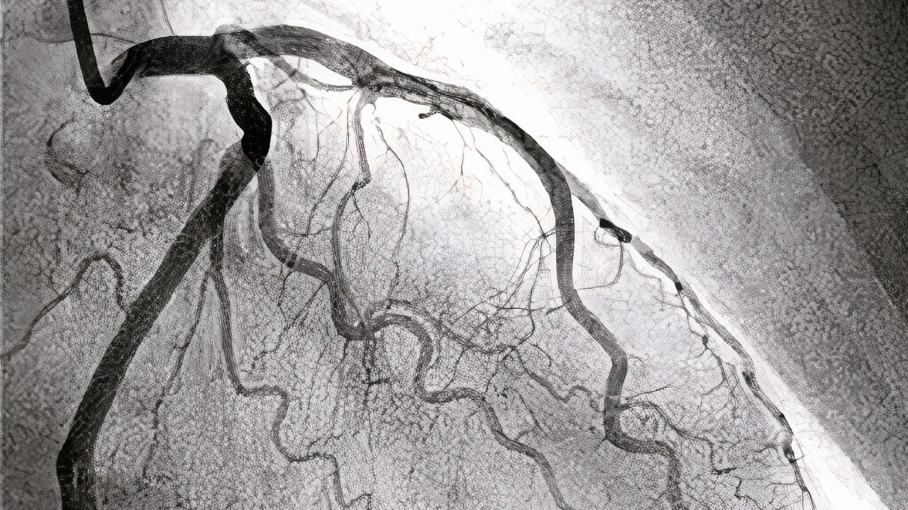 A black and white photo of a tree branch.