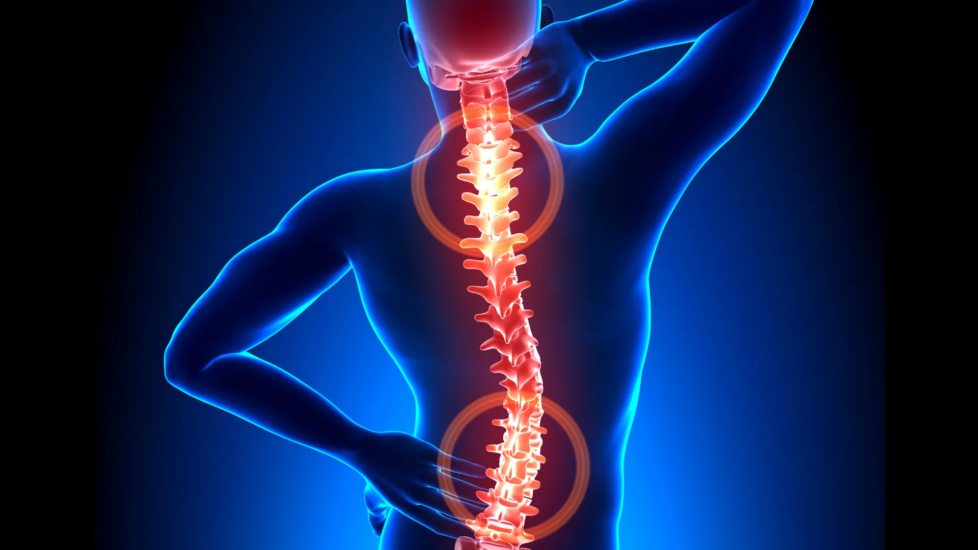 Blue human figure holding neck and lower back with glowing red spine highlighting areas of pain.
