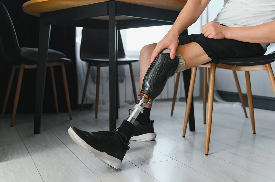 Everything You Need to Know About Loss of Limb Compensation in Car Accident Claims