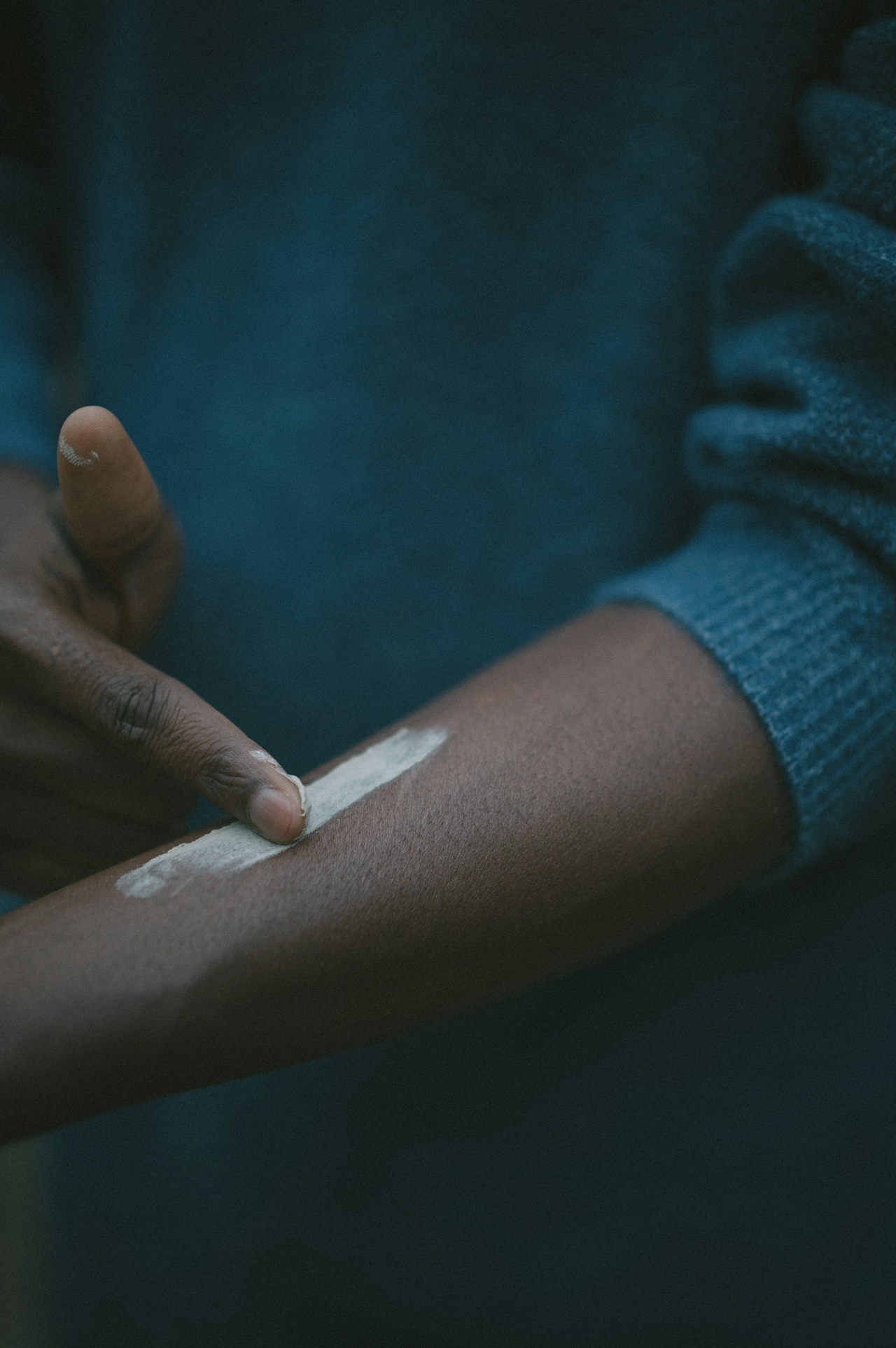 Person applying a topical cream on skin. 