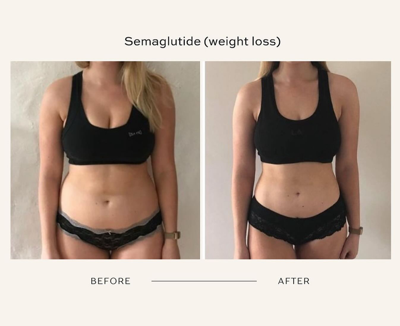 Weight Loss Injections Chicago Illinois