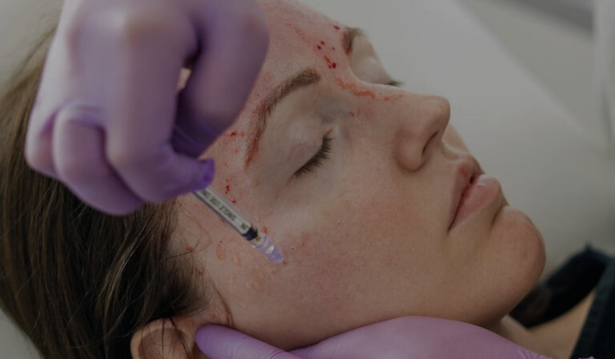 Vampire Facial Chicago Old TOwn