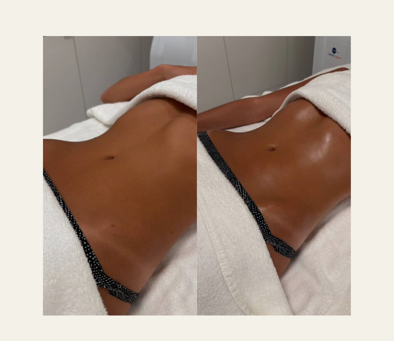 Lymphatic Drainage Treatment Chicago Old Town