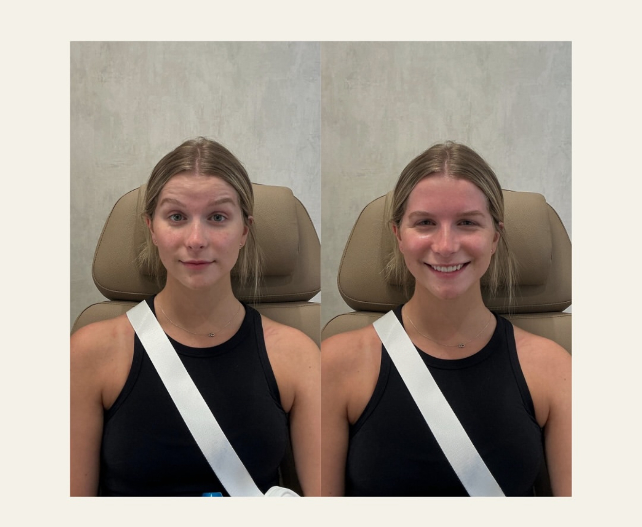 Best Botox Injectables Chicago Skin Bar and Studio