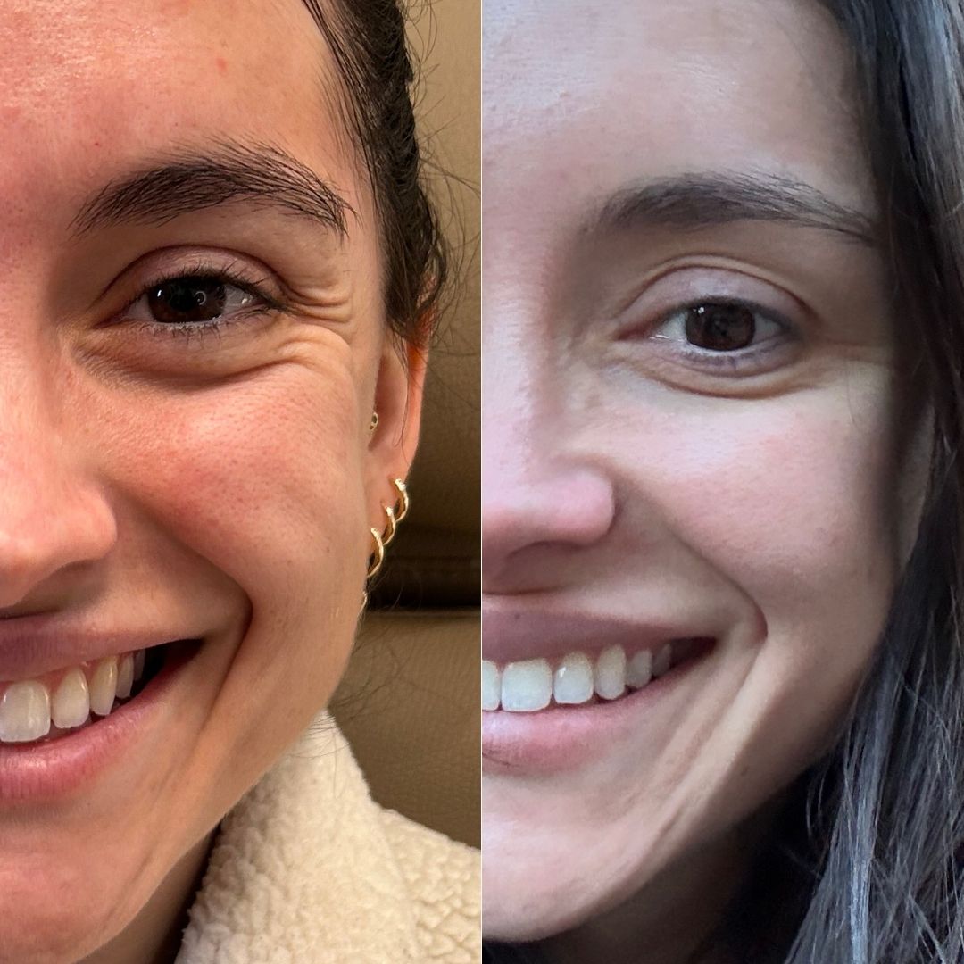 Best Botox Injectables Chicago Skin Bar and Studio