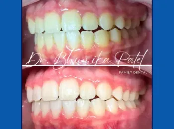 Schaumburg Dental Studio
