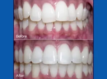 Schaumburg Dental Studio
