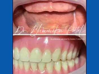 Schaumburg Dental Studio