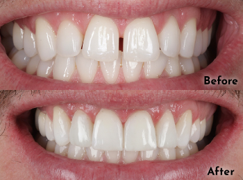 Meliora Dental