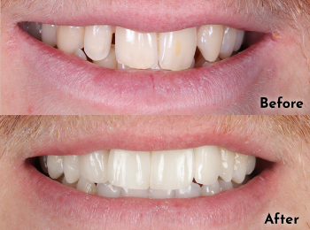Meliora Dental