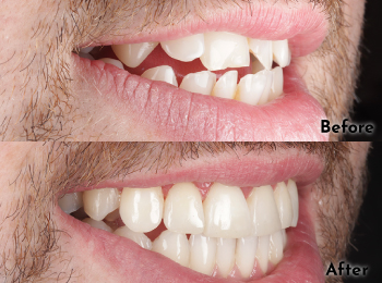 Meliora Dental