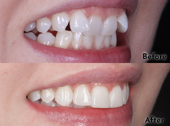 Meliora Dental