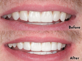 Meliora Dental