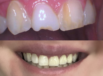 Dental Design Studio