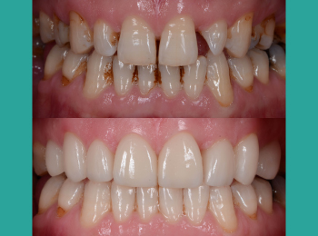 Palmer Dentistry & Implants