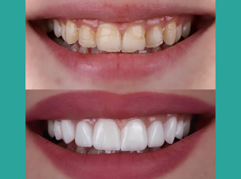 Palmer Dentistry & Implants