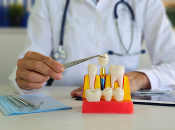 Doctor Wisdom Teeth