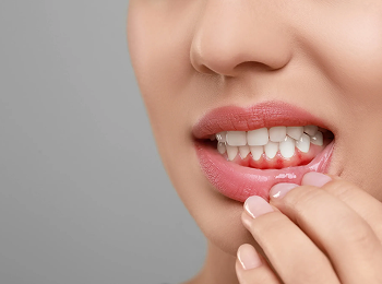 Wisdom Tooth Treatment - Glendale Heights