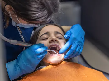 Root Canal Therapy - Glendale Heights