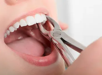 Toothache Relief - Glendale Heights