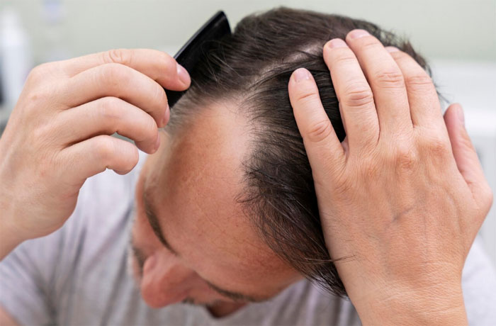 Promotes hair growth