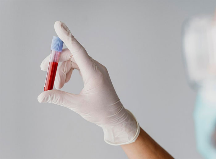 Blood tests