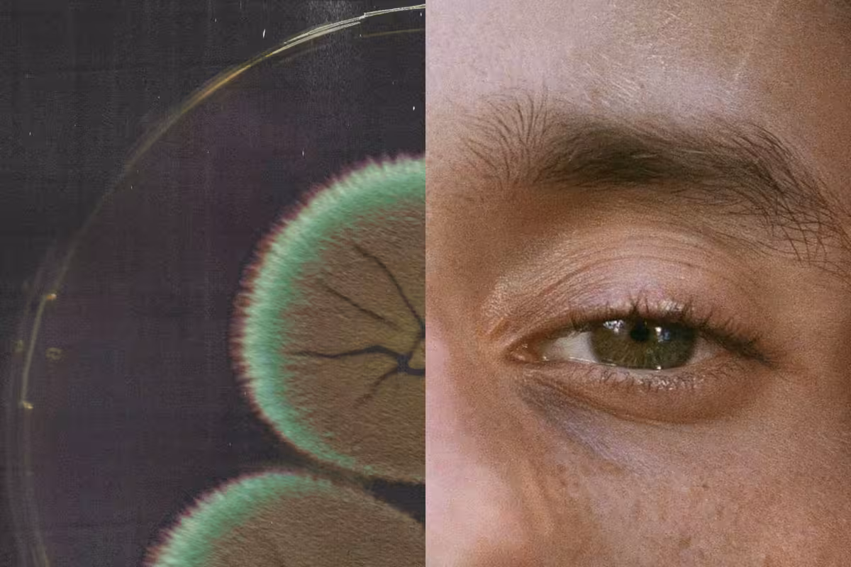 Treating male partners decreases BV recurrence, new study reveals.
