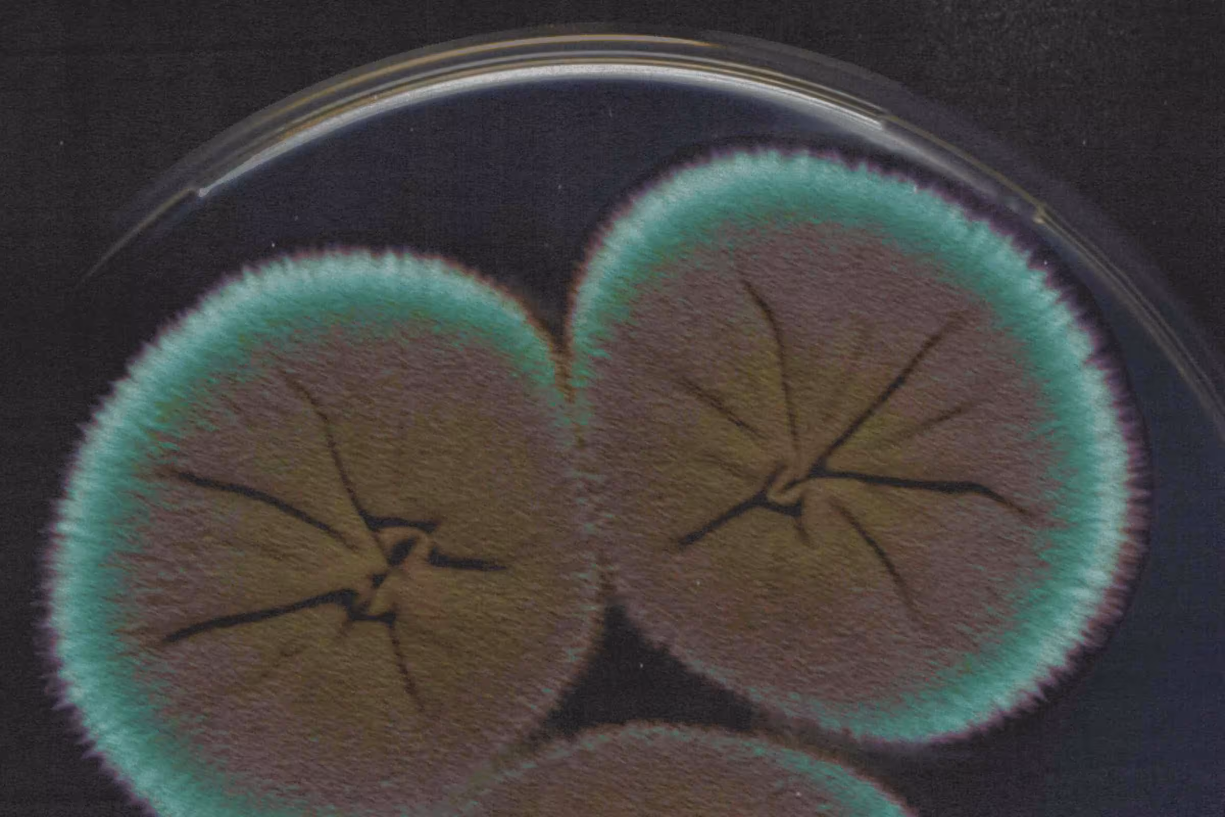 Close up of a bacterial vaginosis microbe