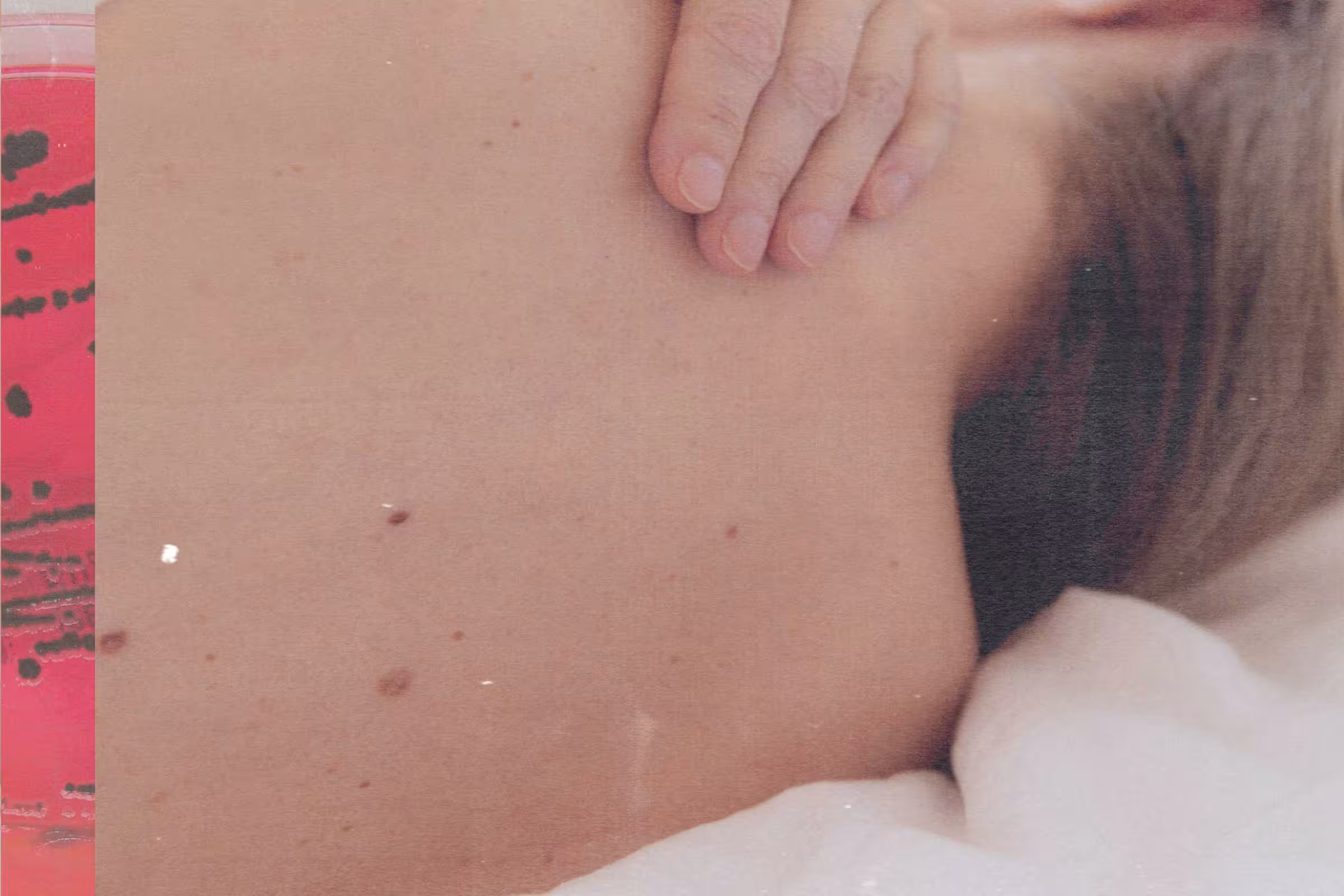 Woman experiencing vaginal dryness and itching