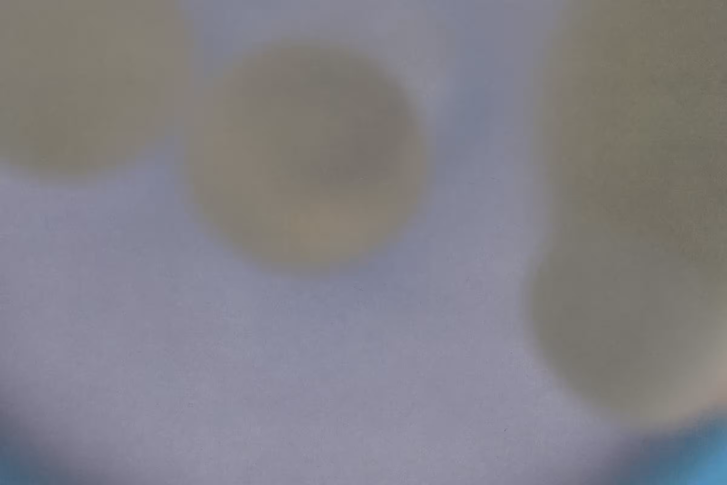 atopobium vaginae bacteria with tints of purple and green