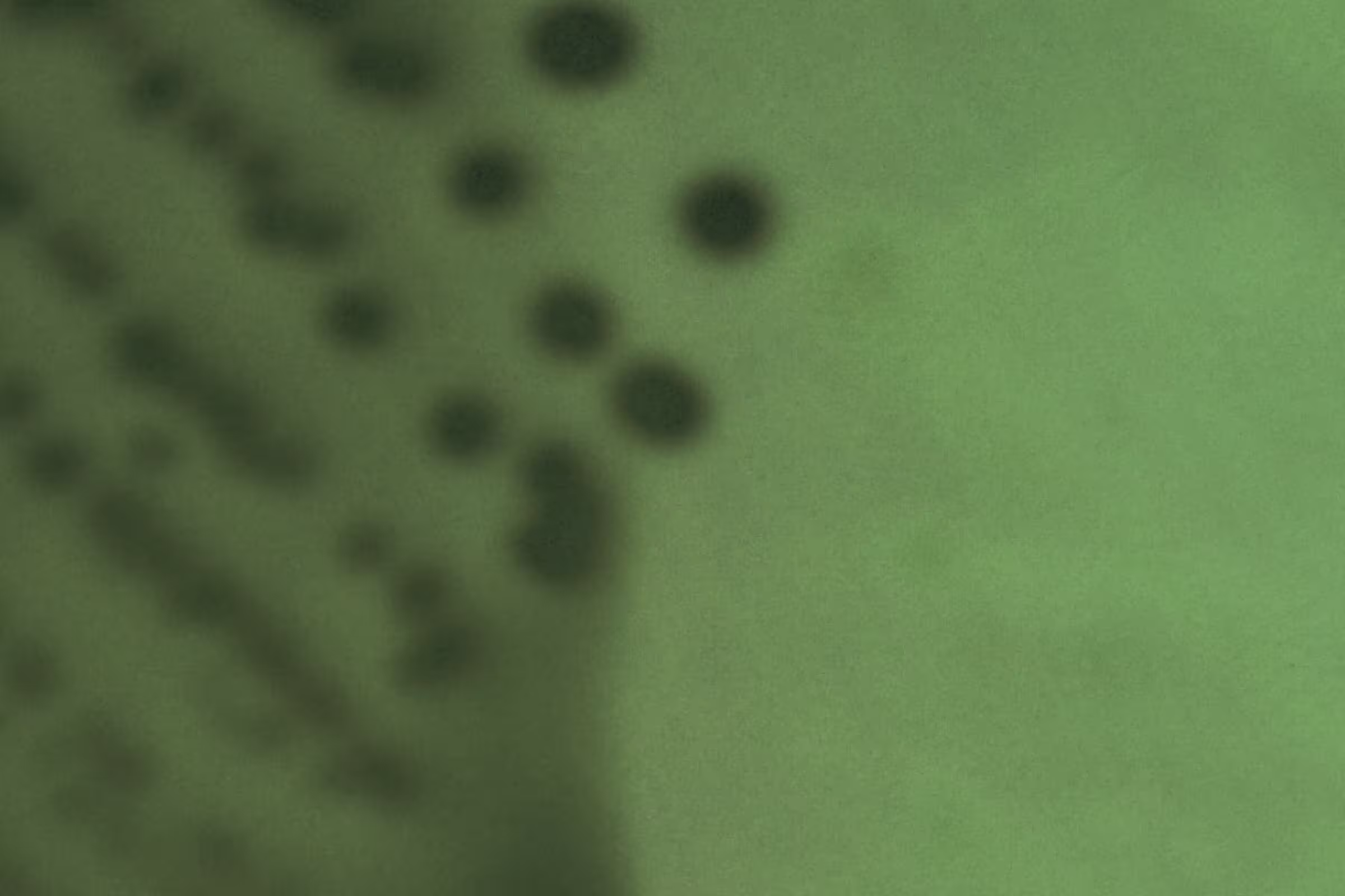 a macro shot of greenish discharge