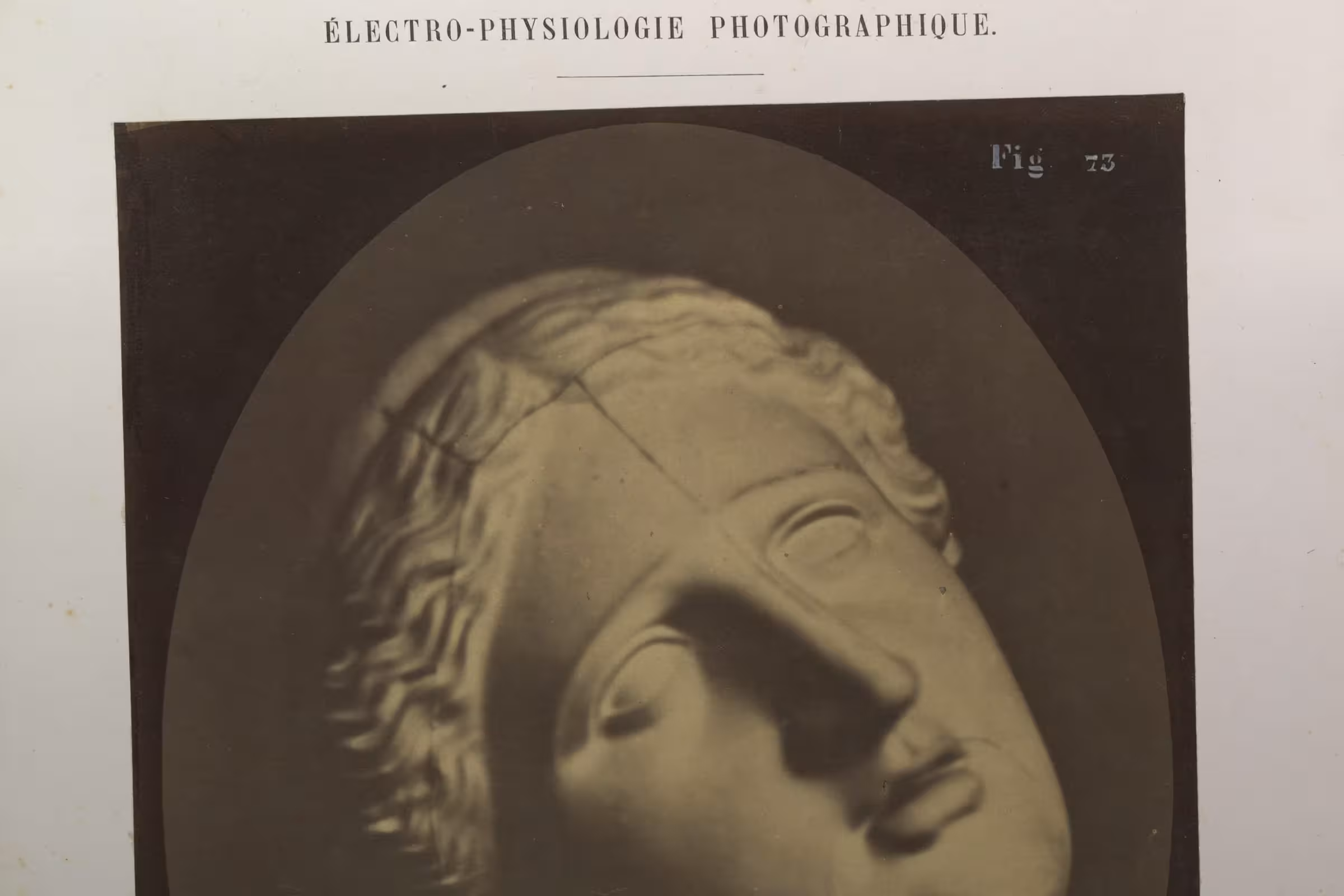 A female statue in dismay as she does not know what to do about her mycoplasma symptoms