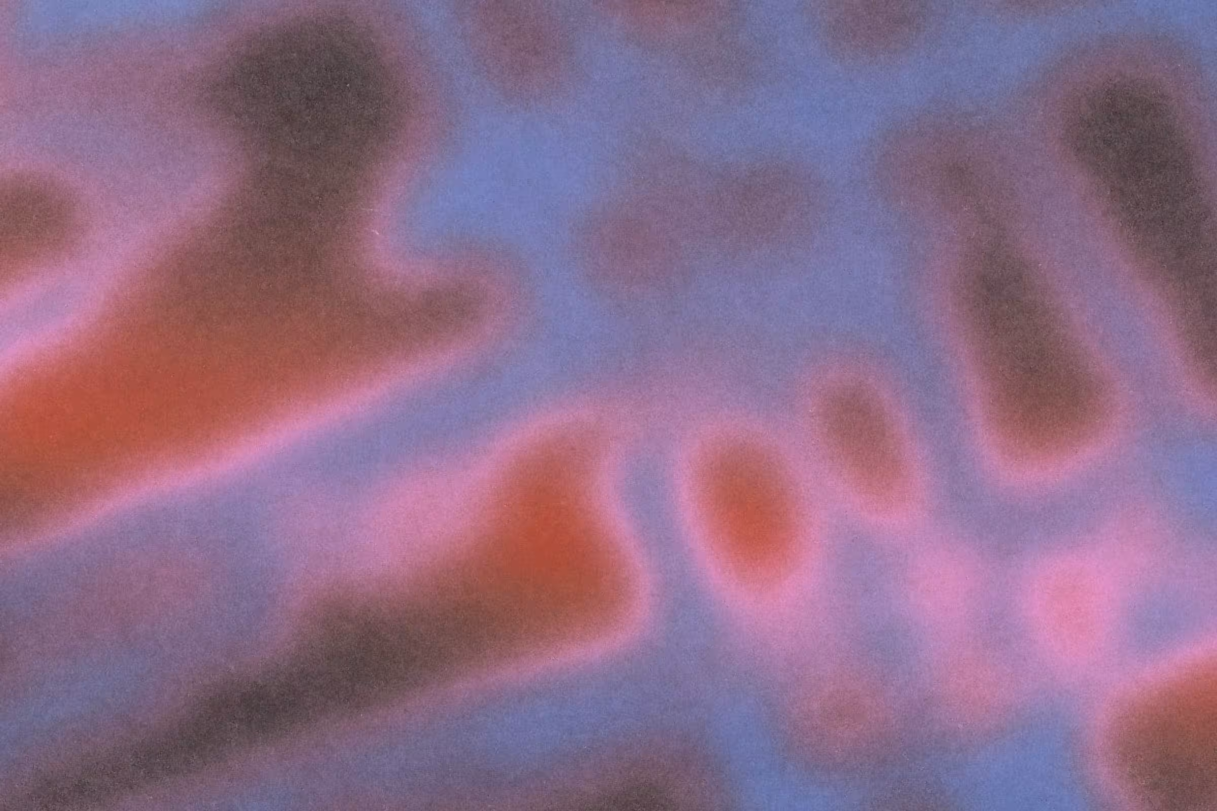 a zoomed in photo of blue and pink bacteria that may cause BV 
