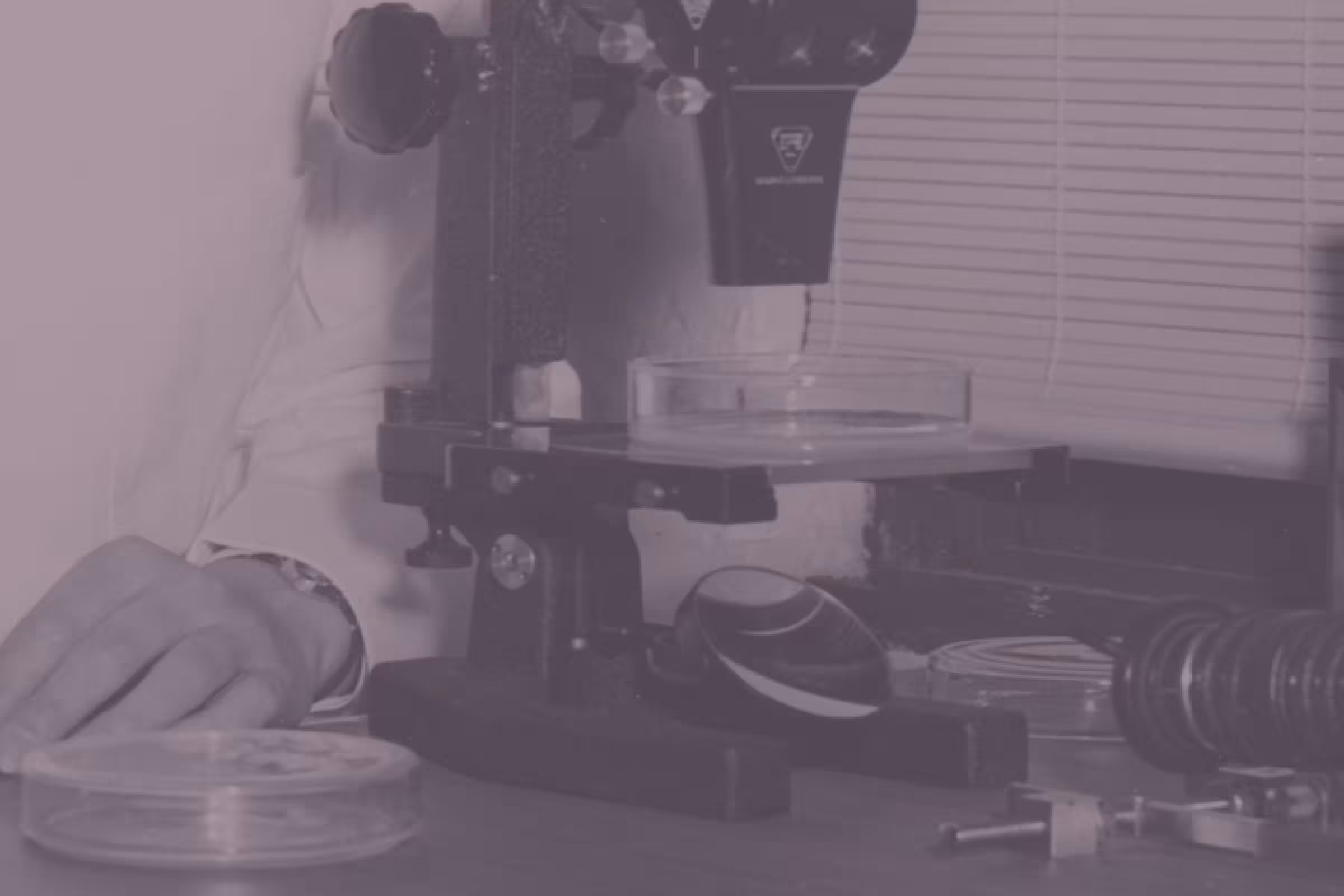 A women looking at common vaginal infections through the microscope and trying to figure out what are the causes
