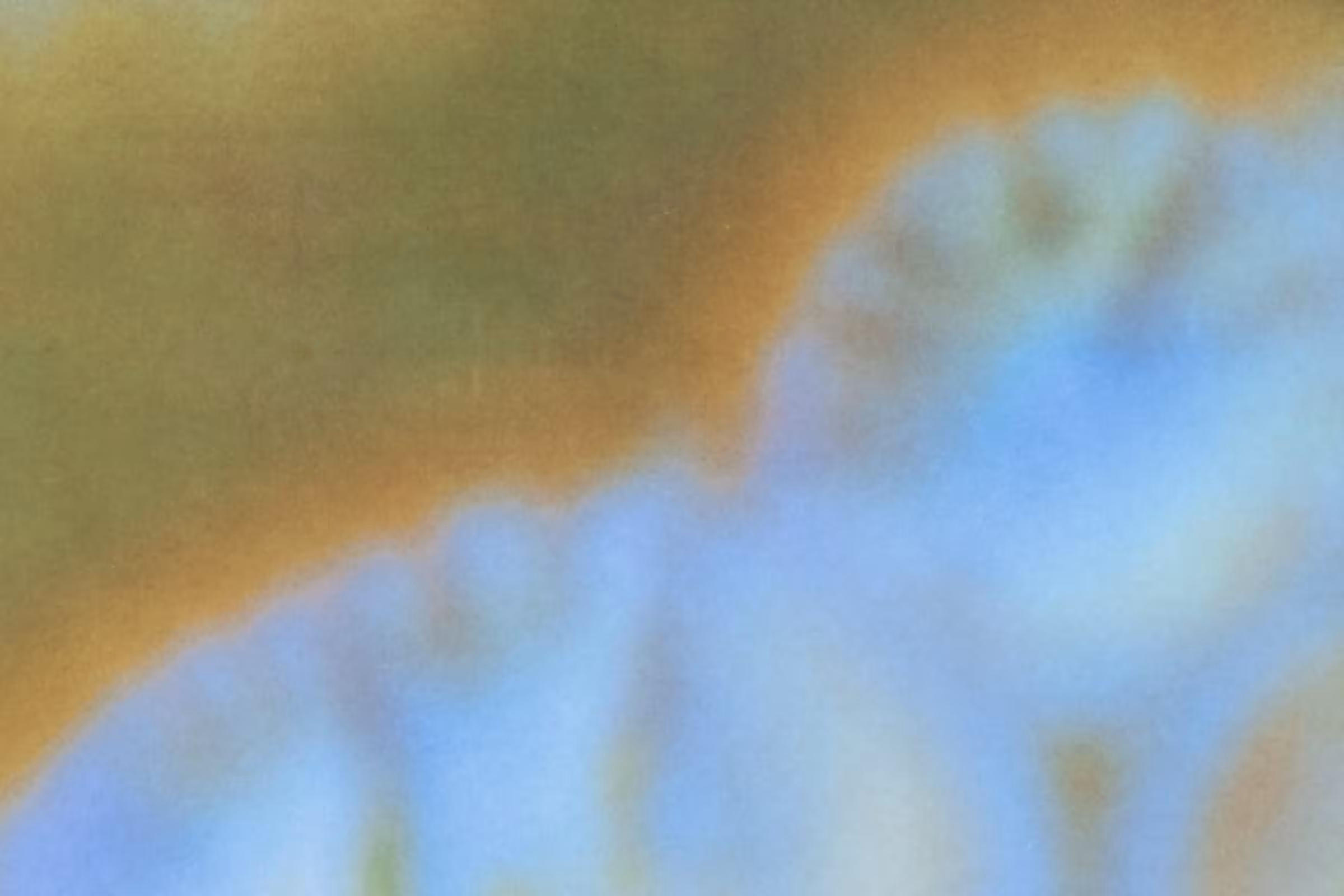 A macro photo of lactobacillli – the protective bacteria. Here, there is too much lactobacilli causing the infection – vaginal lactobacillosis 