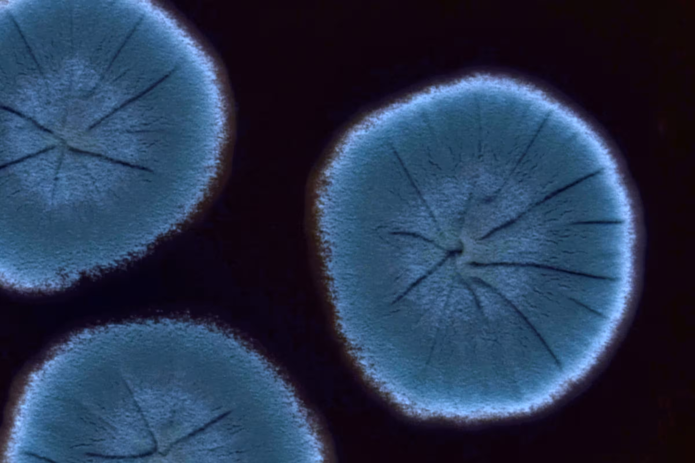 A close-up image of BV bacteria and a blue yeast co-infecting at the same time 