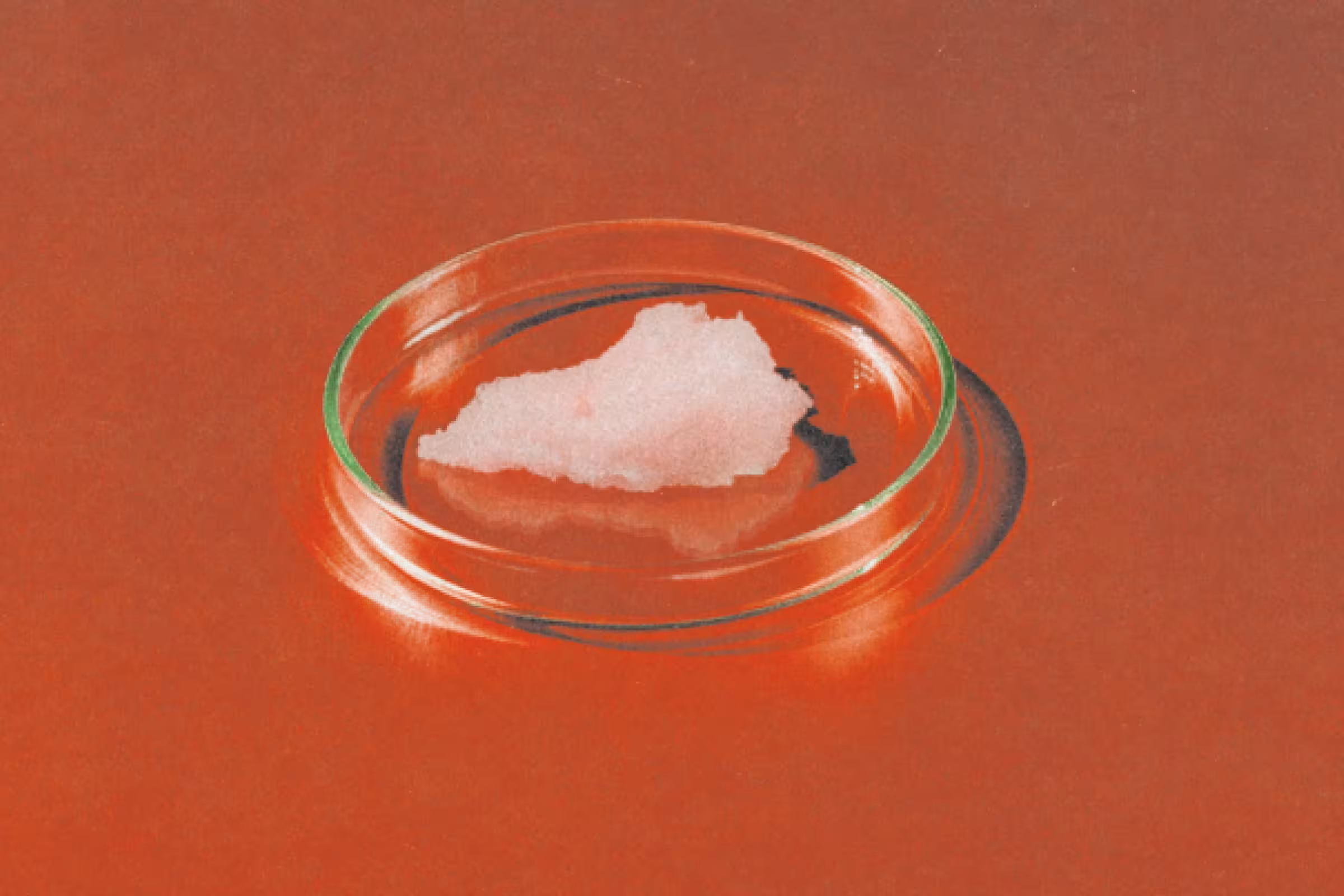 Home Remedies for Yeast Infections & BV