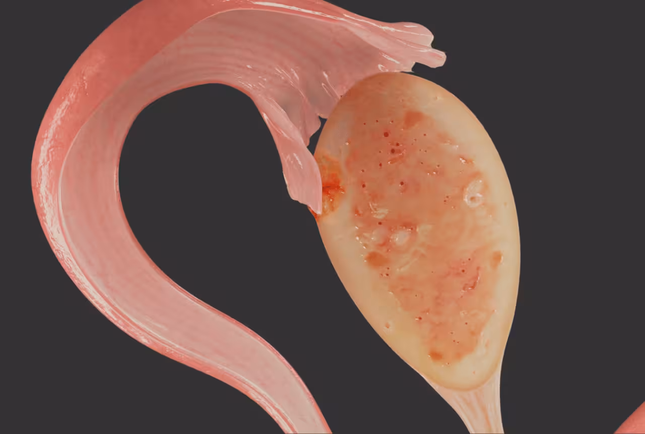 vaginal microbiome and fertility