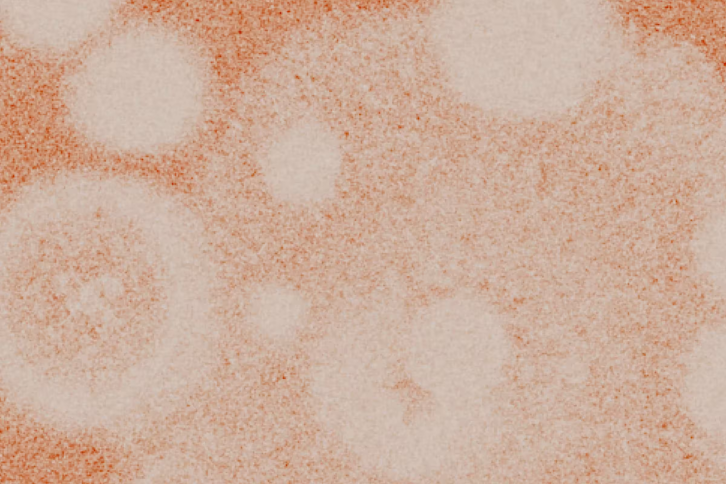 Ureaplasma including Ureaplasma urealyticum and Ureaplasma parvum bacteria