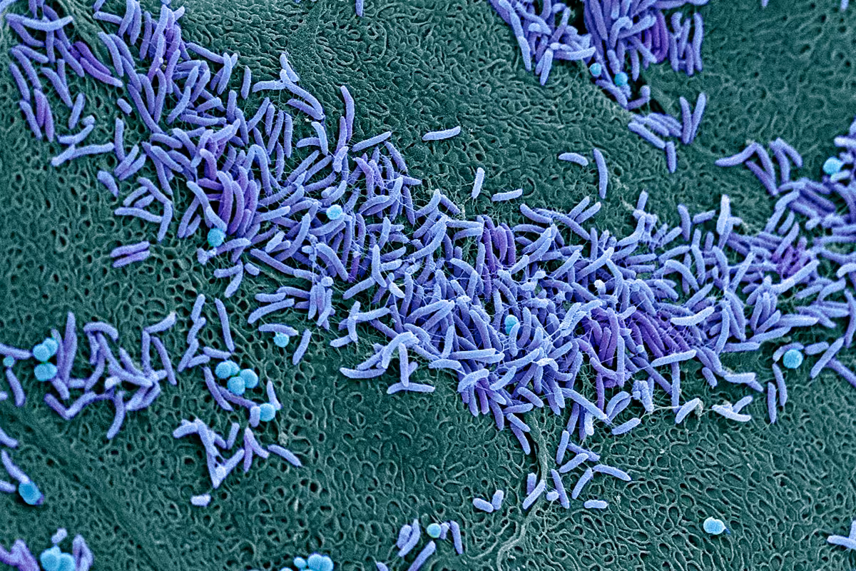 Microscopic image of the Vaginal Microbiome