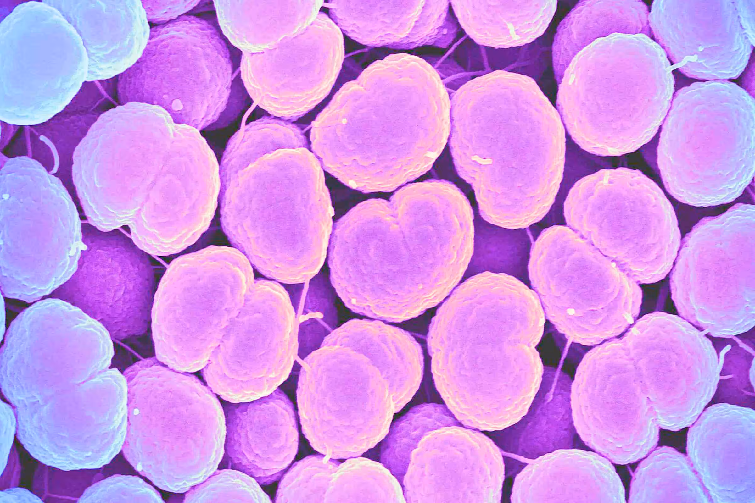 Microscopic image of Neisseria gonorrhoeae, the bacteria behind the STI gonorrhea