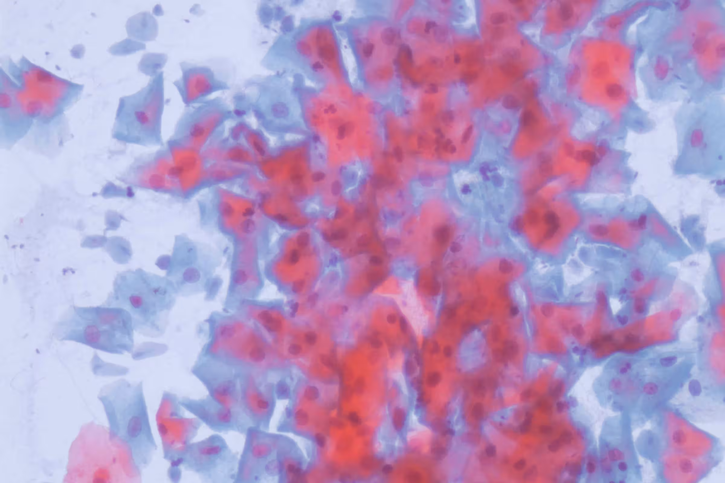 Microscopic image of Trichomonas vaginalis, the parasite behind the STD trichomoniasis or trich