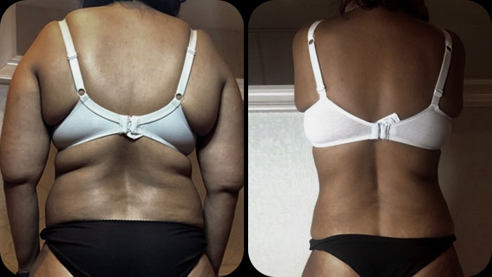 before and after back fat
