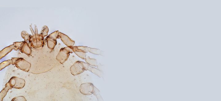 How to know if you have dust mites in your home