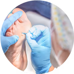 Soin de pédicurie médical