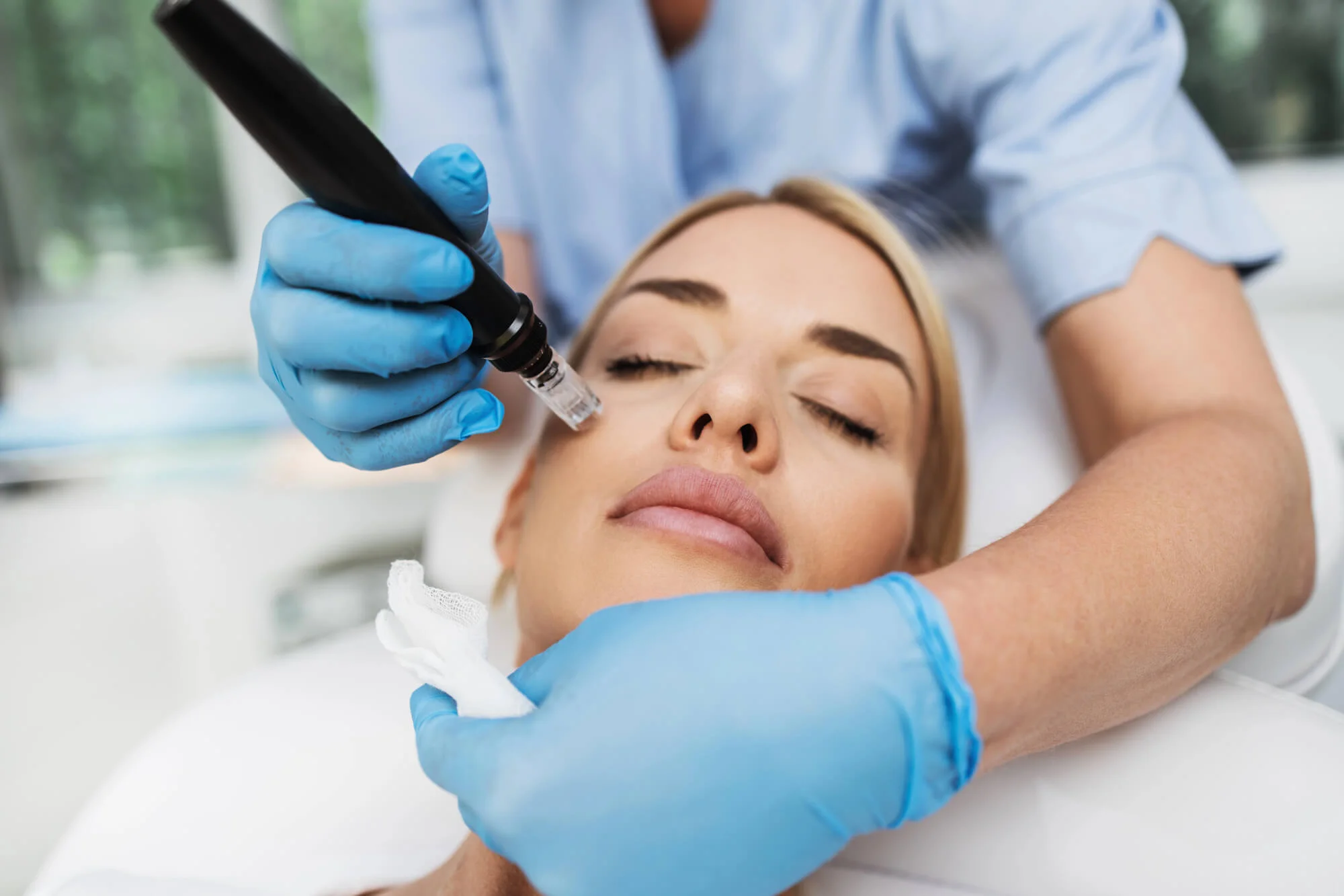 Microneedling in Wellington FL
