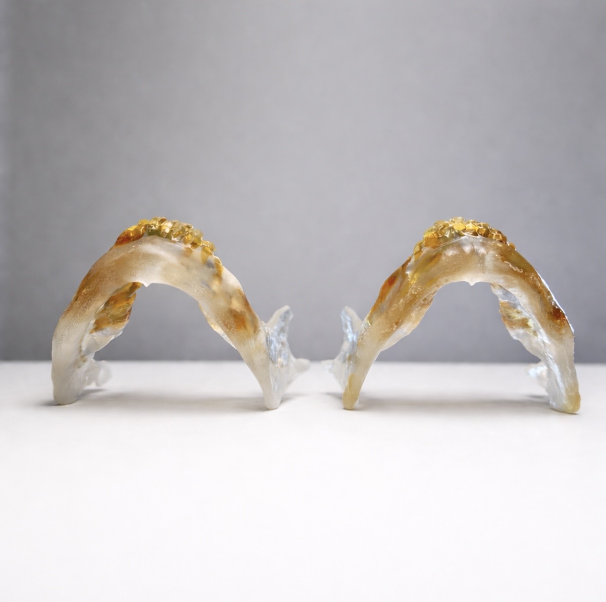 Virtual Surgical Planning (VSP) for Facial Feminization Surgery | Dr. Kriya