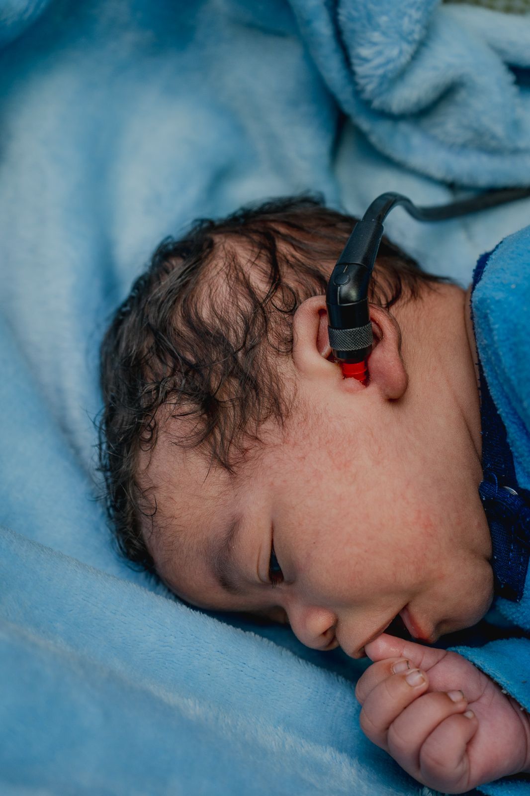 Newborn baby wearing a hearing aid, wrapped in a blue blanket