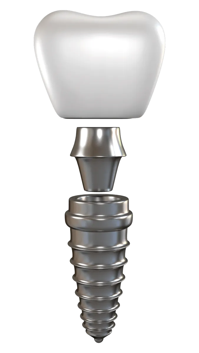 budowa-implantu-olsztyn